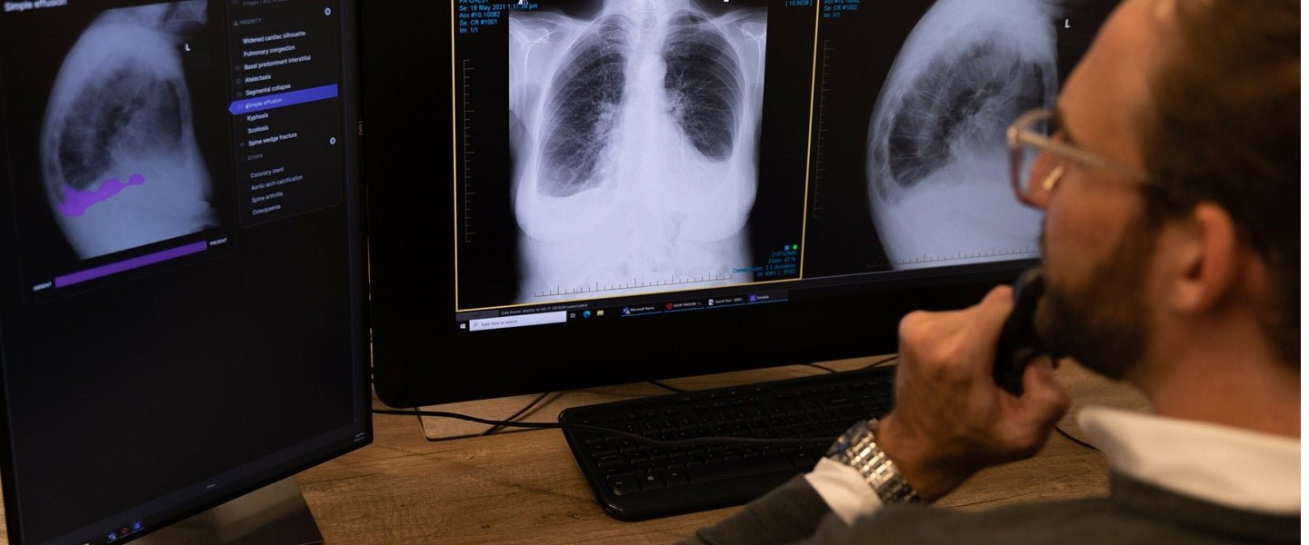 Lunit's AI Solution Impacts Radiologists' Lung Cancer Diagnosis